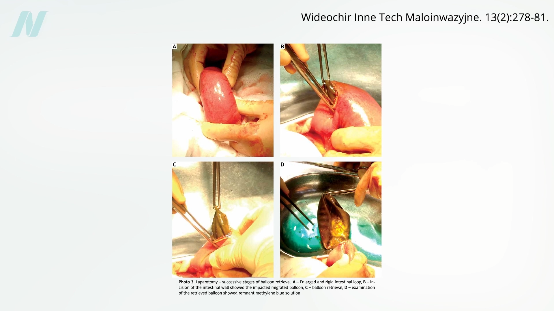 The Alarming Reality: How Sham Surgery Trials Are Revealing the Ineffectiveness of Popular Medical Procedures