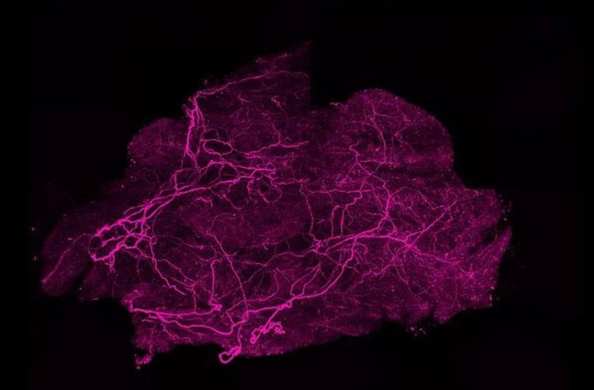 Groundbreaking Research Uncovers Novel Pathway to Combat Obesity by Enhancing Body’s Natural Heat-Generating Brown Fat
