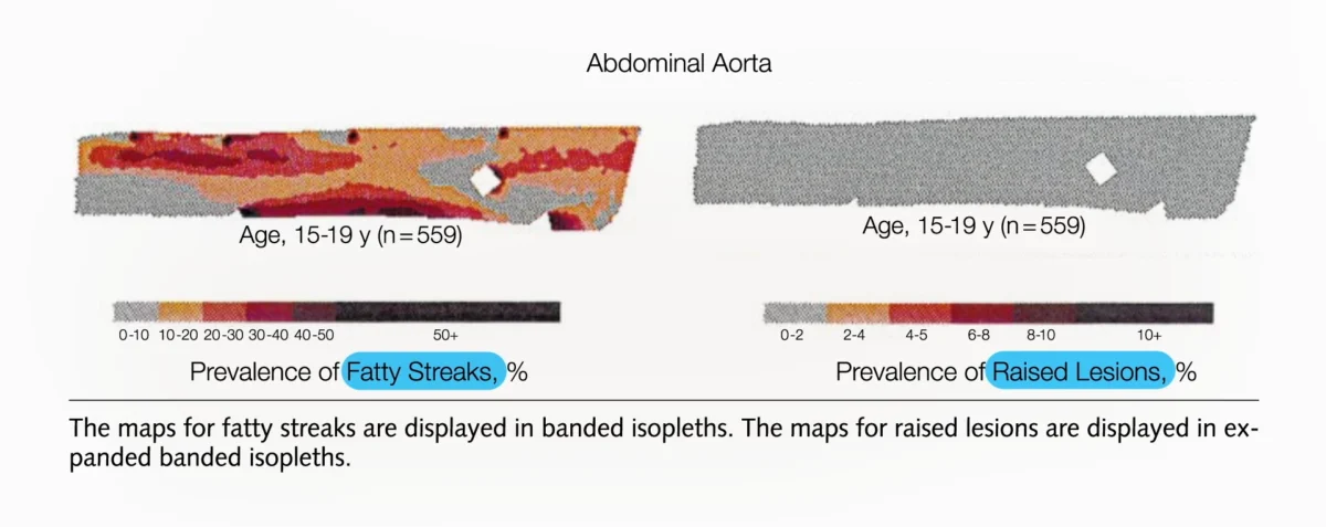 The Lifelong Battle Against Atherosclerosis: Why Lifestyle Trumps Medication in Preventing Heart Attacks