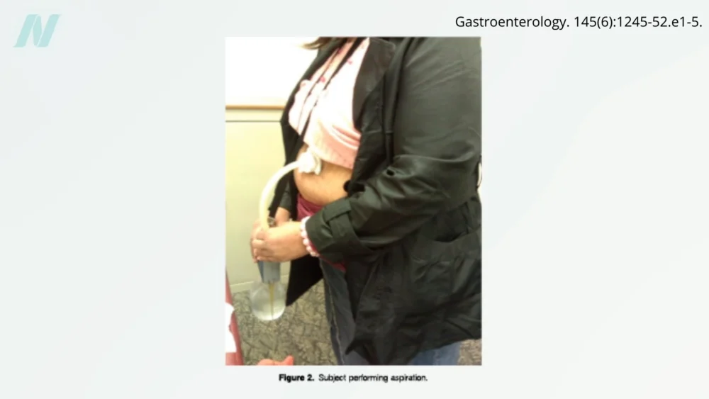 The Perilous Pursuit of Pounds: An Examination of Extreme and Questionable Weight-Loss Methods