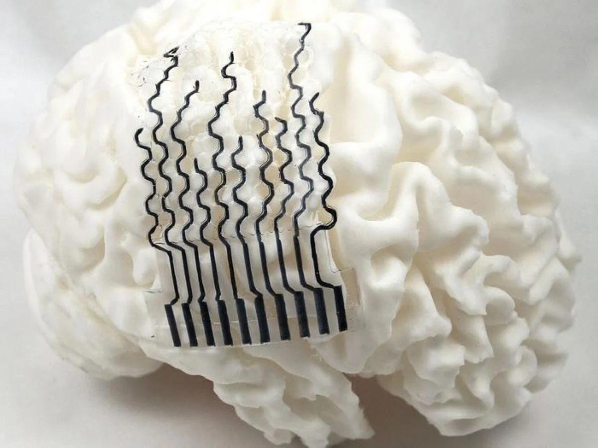 Revolutionary 3D-Printed Bioelectrodes Offer Patient-Specific Neural Interfaces for Enhanced Brain Monitoring and Treatment