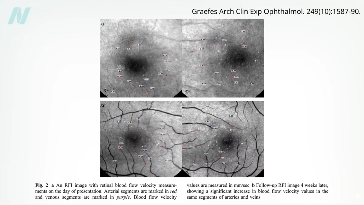 The Impact of Unhealthy Meals on Arterial Health and the Role of Exercise