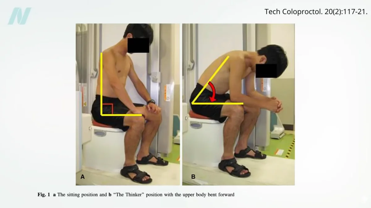 The Squatty Potty Is Put to the Test