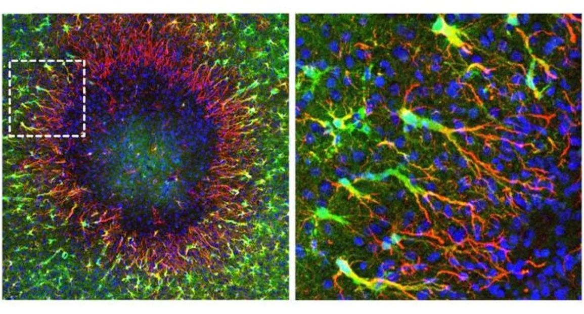 Adult Brain Reveals Unprecedented Self-Repair Mechanism Through Novel Astrocyte Nuclear Migration
