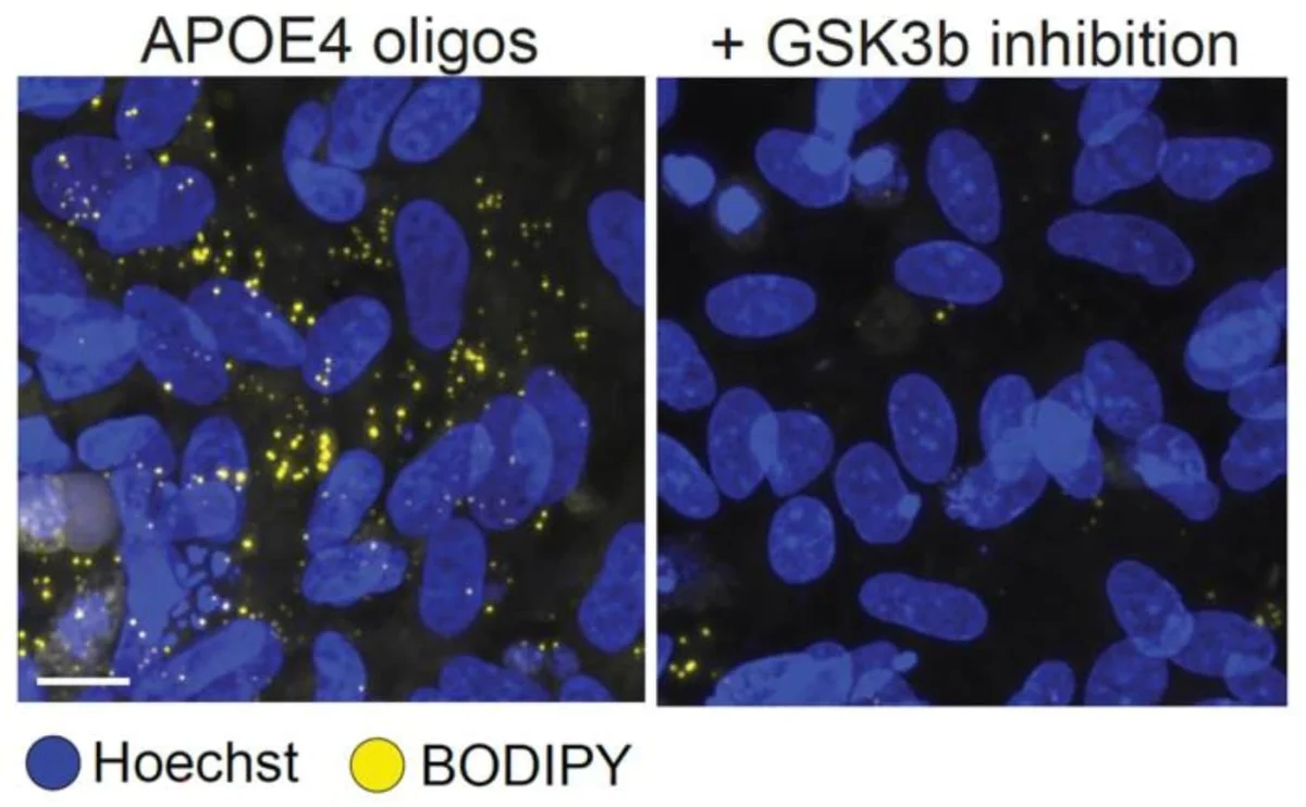 Boosting Wnt Signaling Reverses APOE4 Alzheimer’s Damage